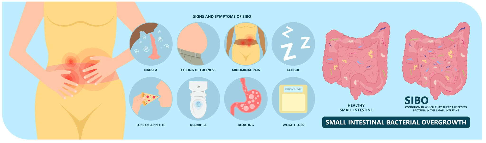 sibo infographic