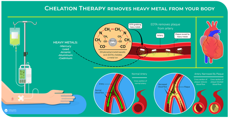 Chelation Therapy infographic