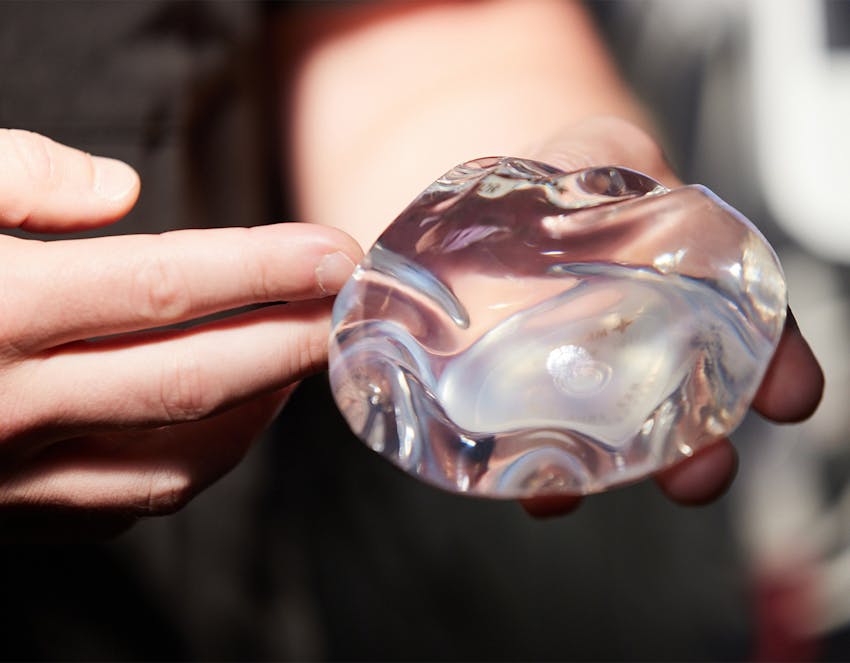 A breast implant
