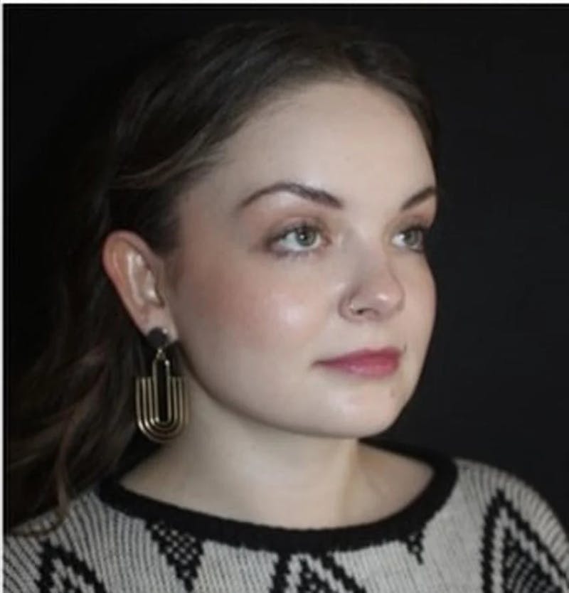 Submental Liposuction Before & After Gallery - Patient 117369 - Image 2