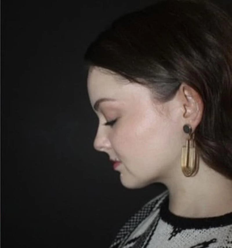 Submental Liposuction Before & After Gallery - Patient 117369 - Image 4