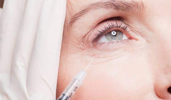 Botox injections for sunken eyes