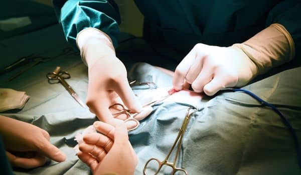 Surgical approach for a BBL