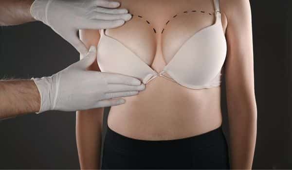 Causes of saggy breasts