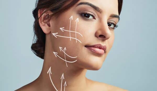 SMAS facelift Dr. Chopra