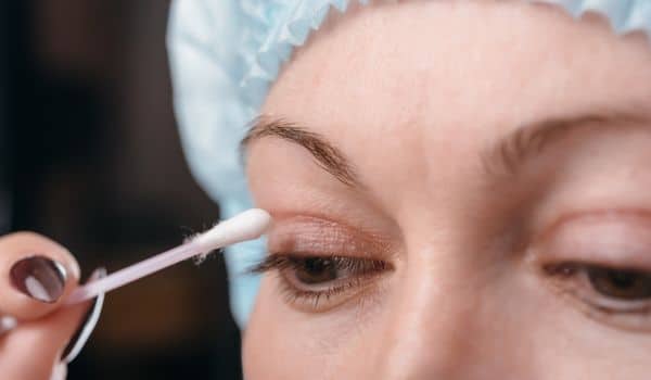 Scarring after blepharoplasty