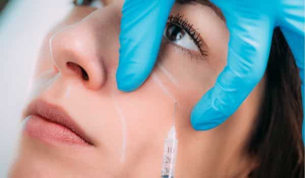 Dermal fillers for chubby cheeks Dr Chopra