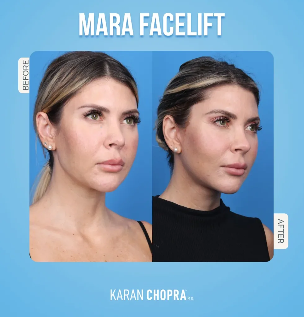 30 Dic jpg e1712124546315