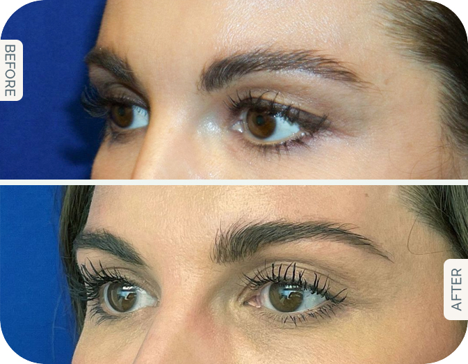 Jelena Before and after blog 3