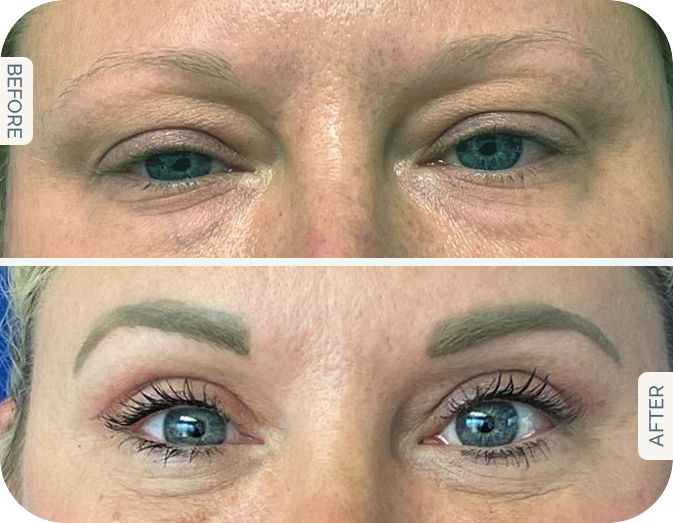 Caitlin Austin Before and after blog 4