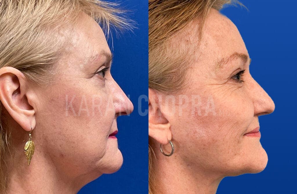 Chopra Plastic Surgery Expands To Miami