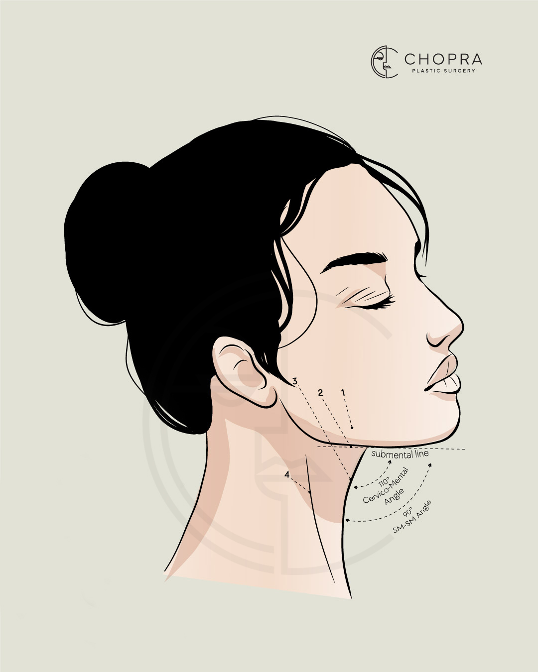 Infographic of Woman's Neck