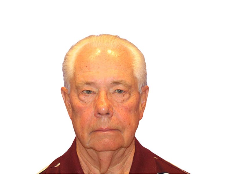 Facelift Before & After Gallery - Patient 767599 - Image 5