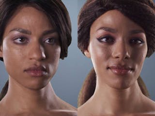 Facial Feminization Before & After Gallery - Patient 127806 - Image 8