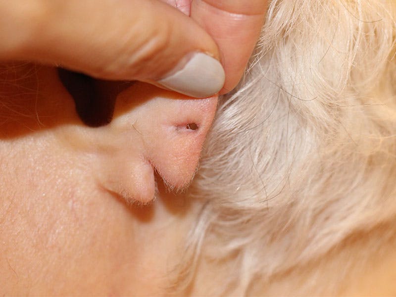 Ear Surgery Before & After Gallery - Patient 162248 - Image 1