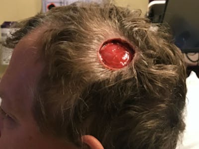 Facial Reconstruction Before & After Gallery - Patient 358071 - Image 1