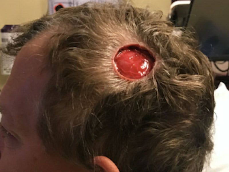 Facial Reconstruction Before & After Gallery - Patient 358071 - Image 1