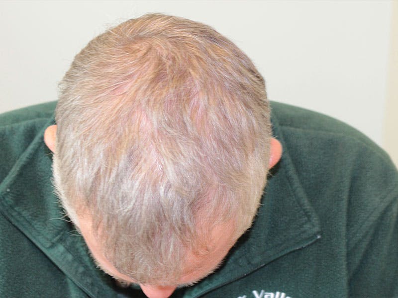 Facial Reconstruction Before & After Gallery - Patient 358071 - Image 2