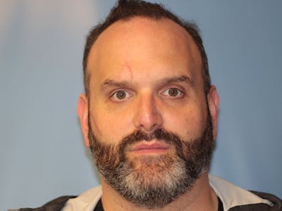 Nasal Reconstruction Before & After Gallery - Patient 406100 - Image 2