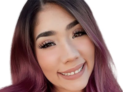 Botox Before & After Gallery - Patient 836338 - Image 2