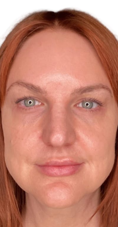 Skin Transformation Before & After Gallery - Patient 807669 - Image 2