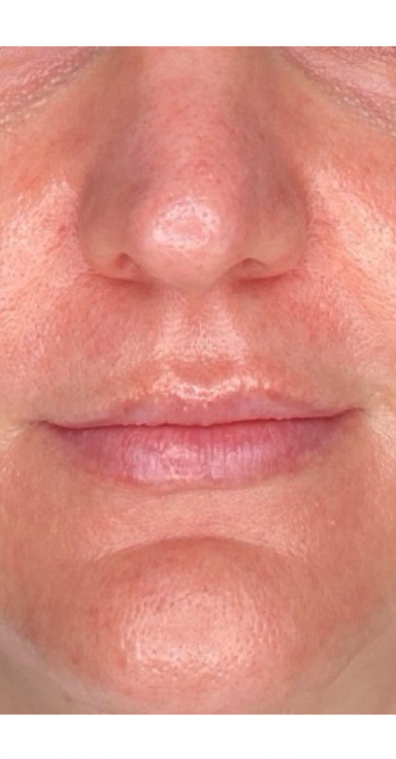 Skin Transformation Before & After Gallery - Patient 807669 - Image 5