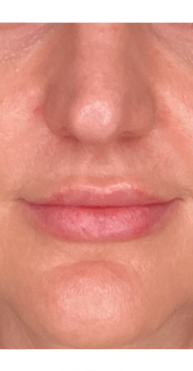 Skin Transformation Before & After Gallery - Patient 807669 - Image 6