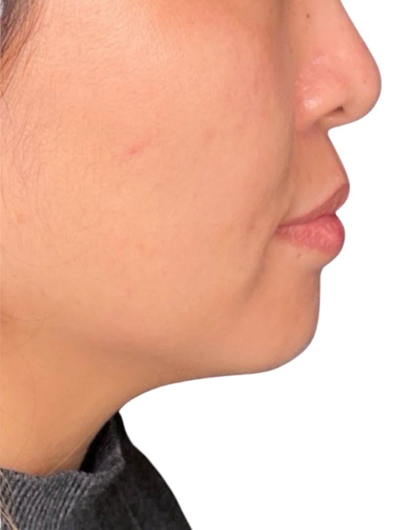Skin Transformation Before & After Gallery - Patient 266251 - Image 2