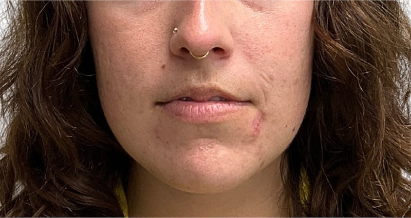 Skin Transformation Before & After Gallery - Patient 358091 - Image 1