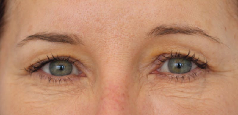 Skin Transformation Before & After Gallery - Patient 259943 - Image 1