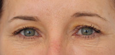 Skin Transformation Before & After Gallery - Patient 259943 - Image 1