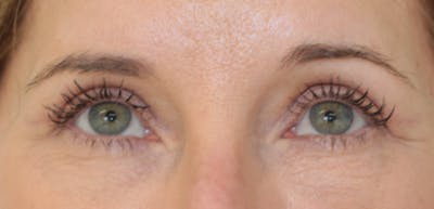 Skin Transformation Before & After Gallery - Patient 259943 - Image 2