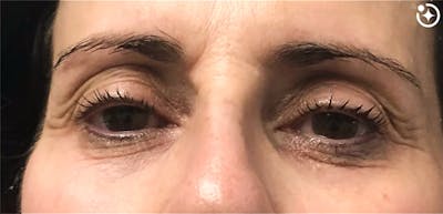 Skin Transformation Before & After Gallery - Patient 488479 - Image 1