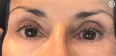 Skin Transformation Before & After Gallery - Patient 488479 - Image 2