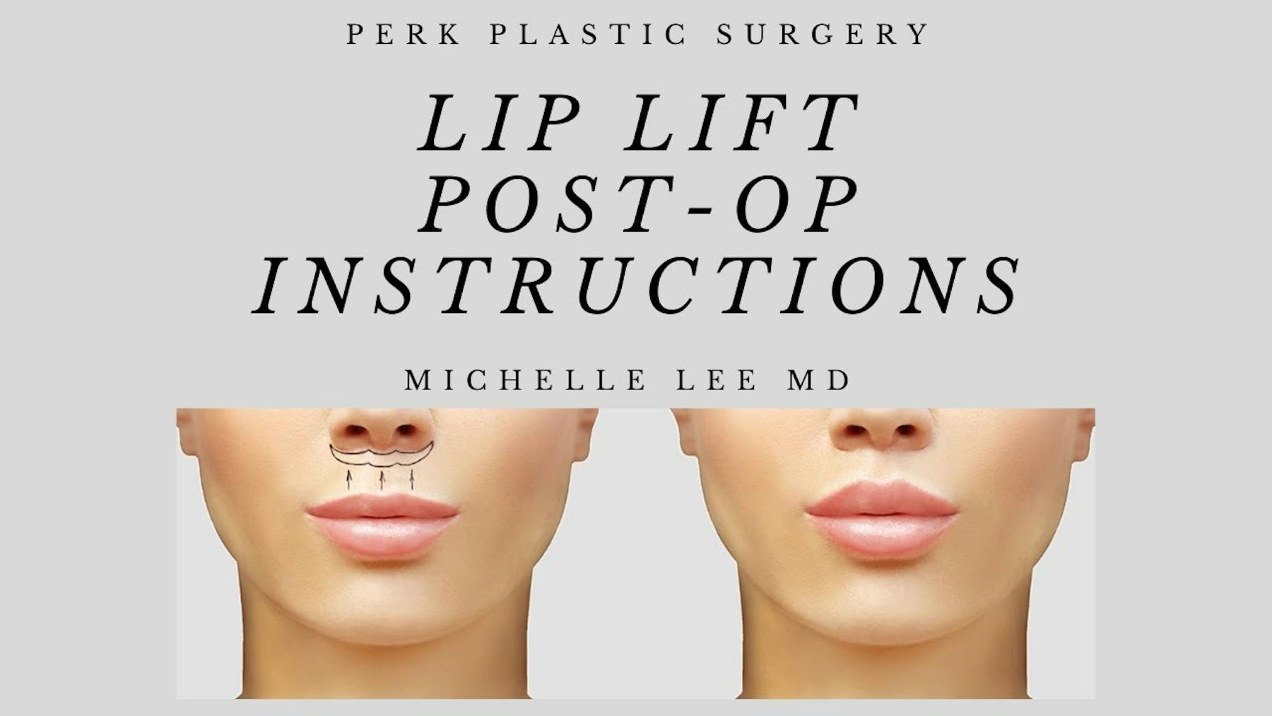 PERK Plastic Surgery