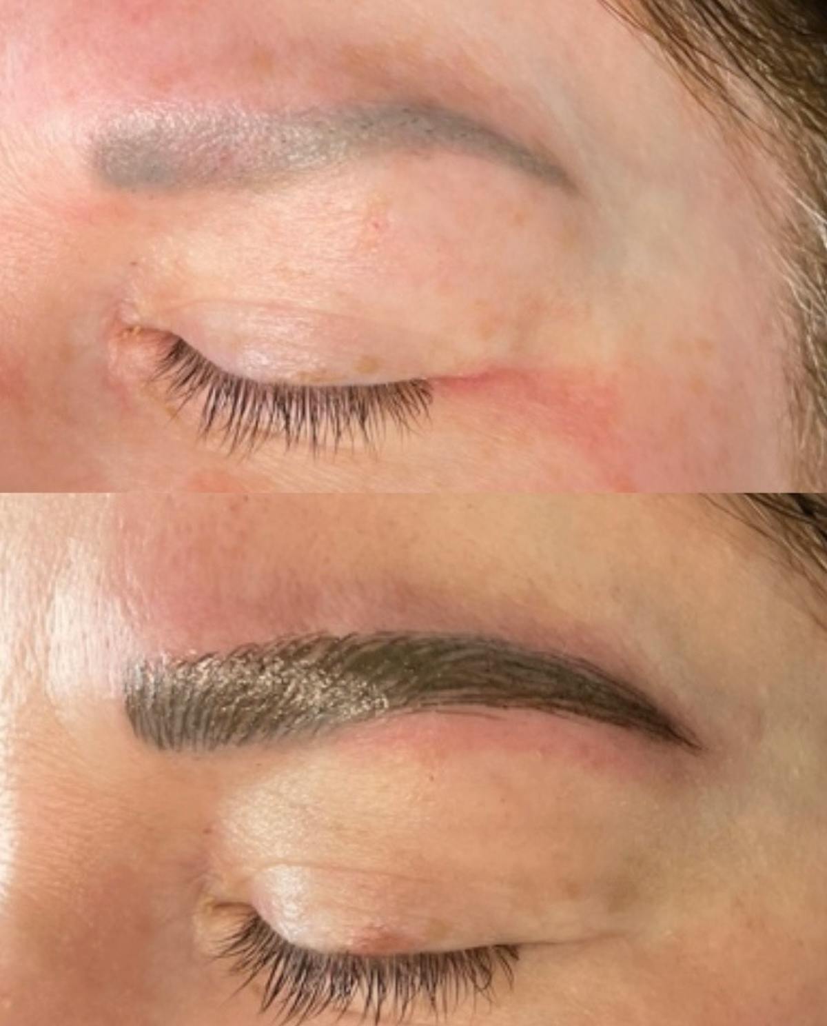 Eyebrow Microblading Before & After Gallery - Patient 326213 - Image 1