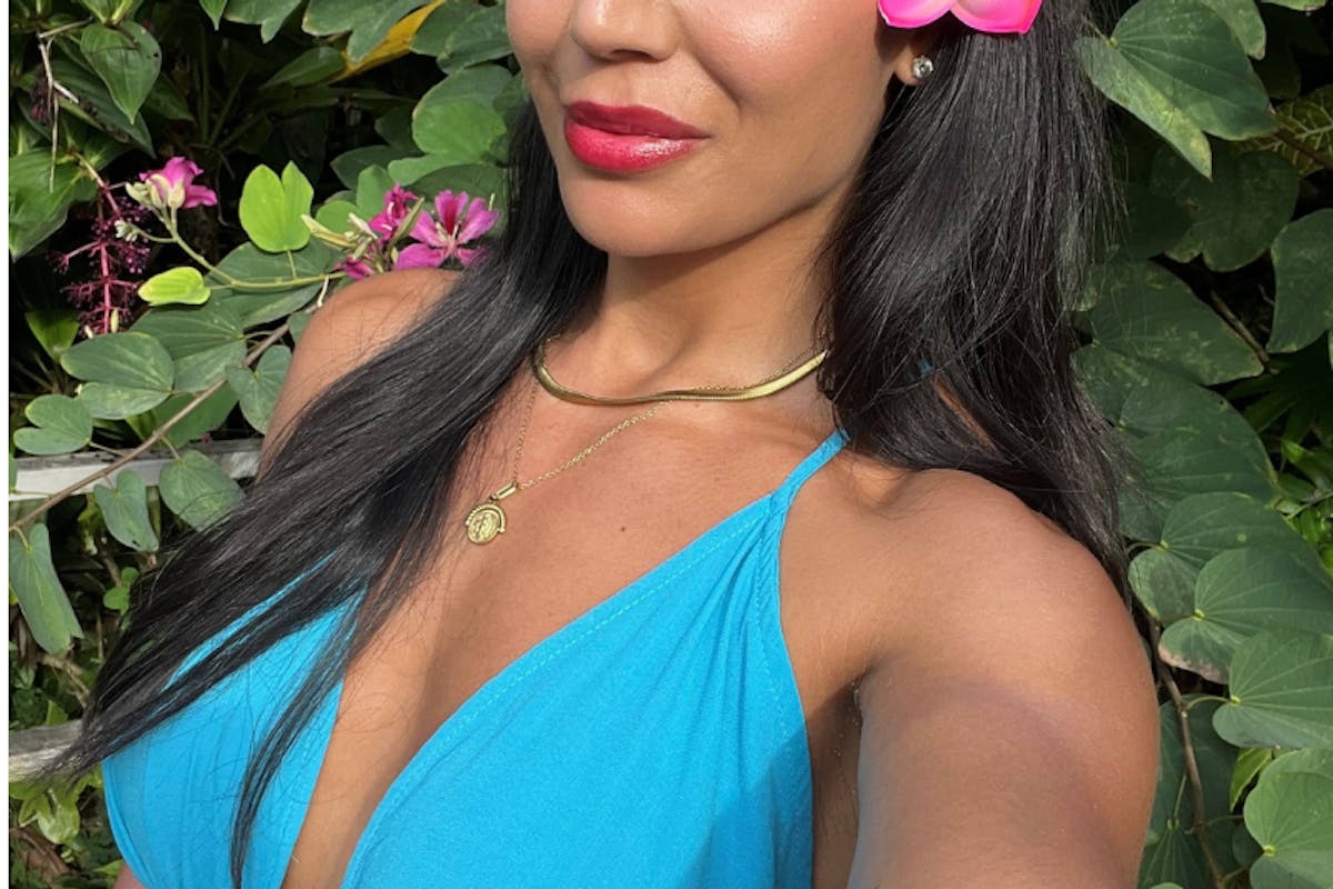 Patient Selfies Before & After Gallery - Patient 307441 - Image 1