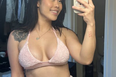 Patient Selfies Before & After Gallery - Patient 581339 - Image 1