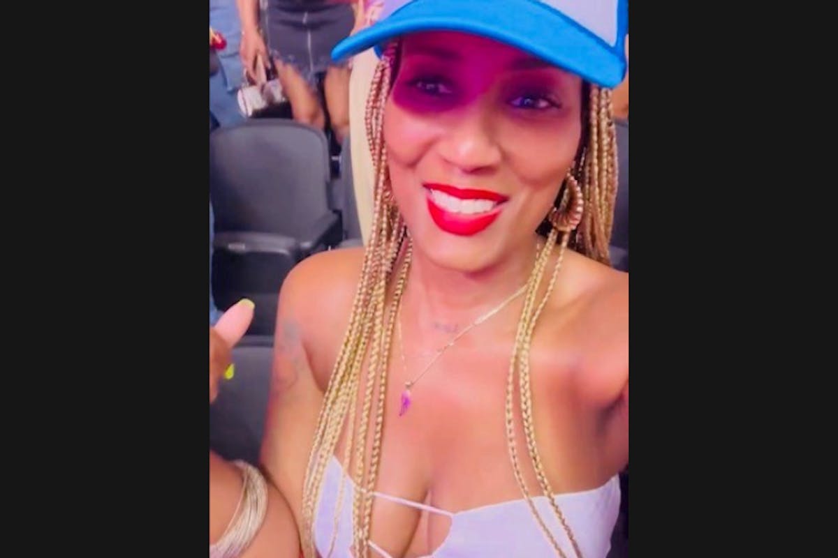 Patient Selfies Before & After Gallery - Patient 356066 - Image 1