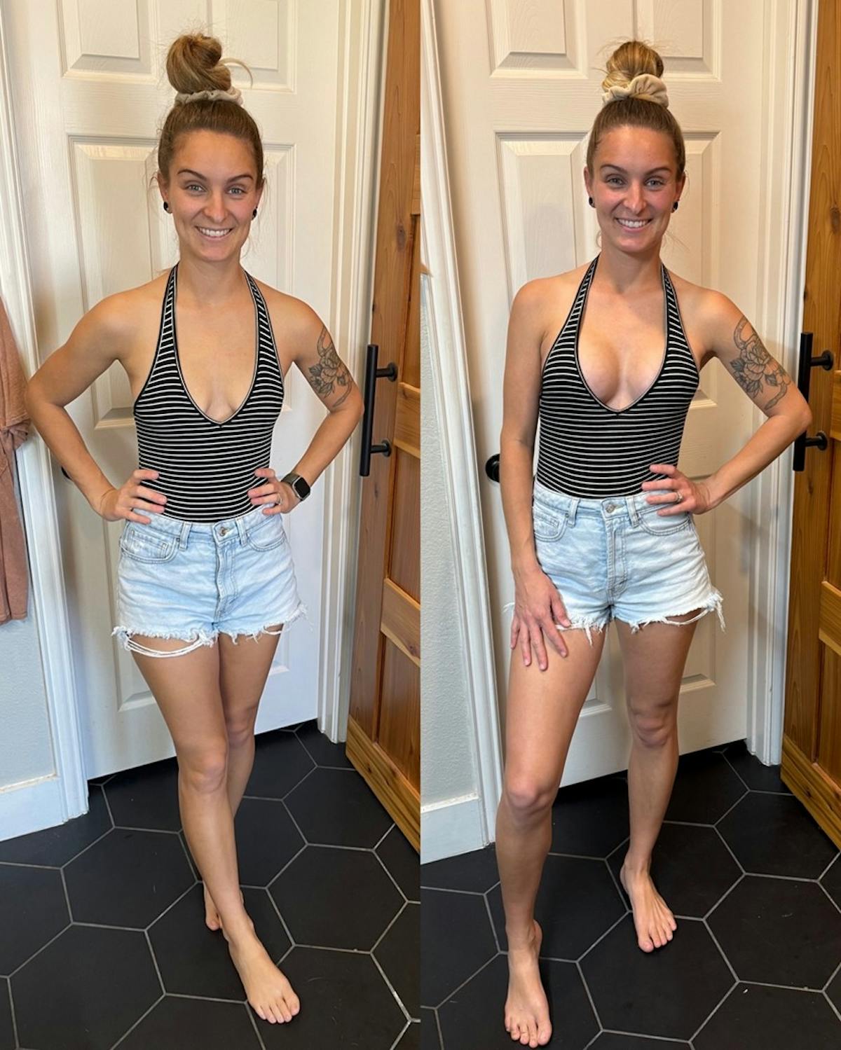 Patient Selfies Before & After Gallery - Patient 279143 - Image 2