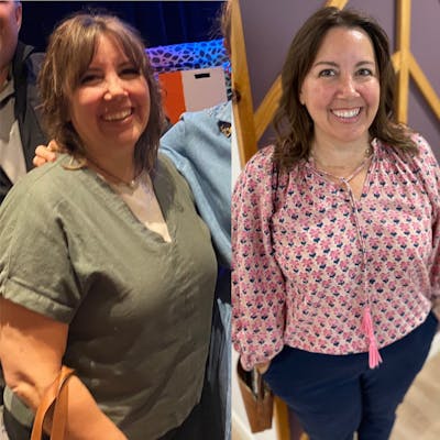 Patient Selfies Before & After Gallery - Patient 197703 - Image 1