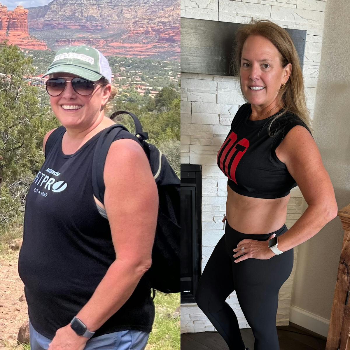 Patient Selfies Before & After Gallery - Patient 193194 - Image 1