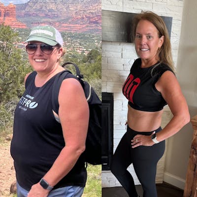 Patient Selfies Before & After Gallery - Patient 193194 - Image 1