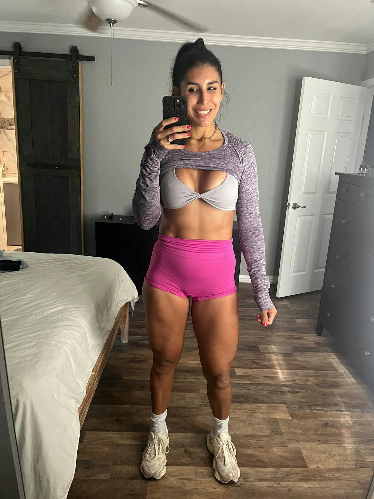 Patient Selfies Before & After Gallery - Patient 753958 - Image 1