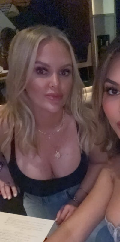 Patient Selfies Before & After Gallery - Patient 129014 - Image 1