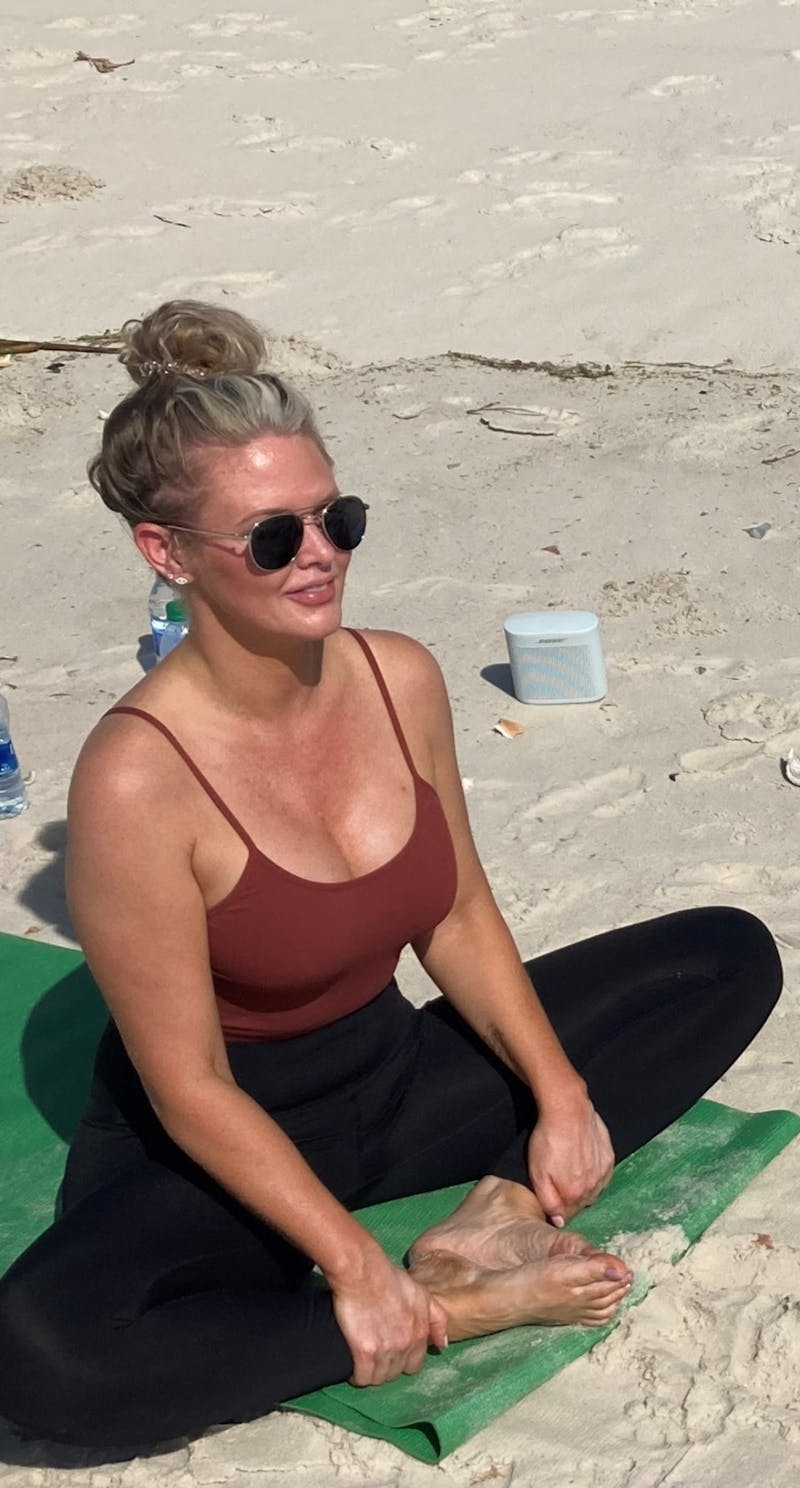 Patient Selfies Before & After Gallery - Patient 268174 - Image 1