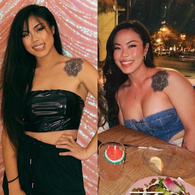 Patient Selfies Before & After Gallery - Patient 253492 - Image 1