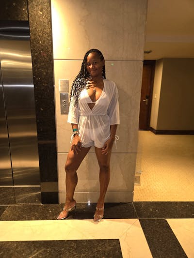 Patient Selfies Before & After Gallery - Patient 391373 - Image 1