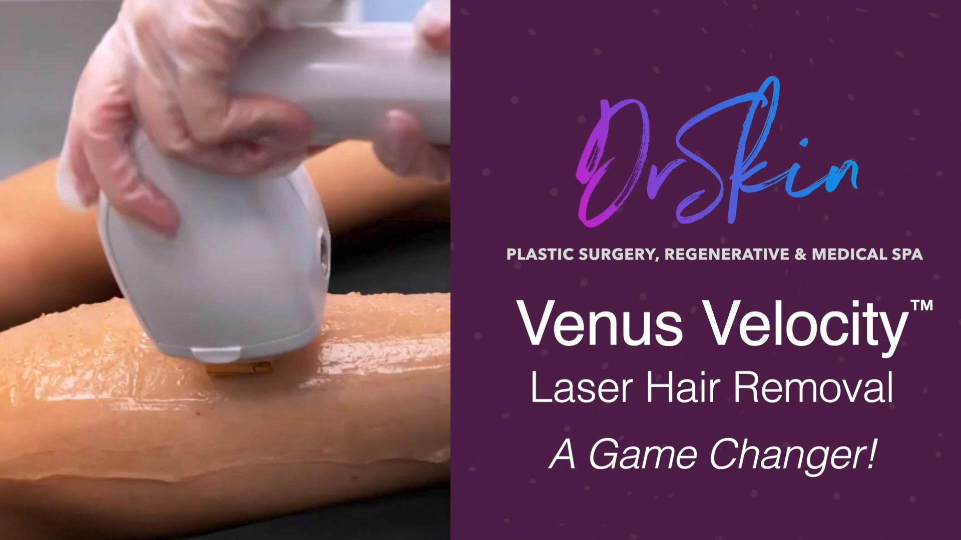 venus velocity treatment