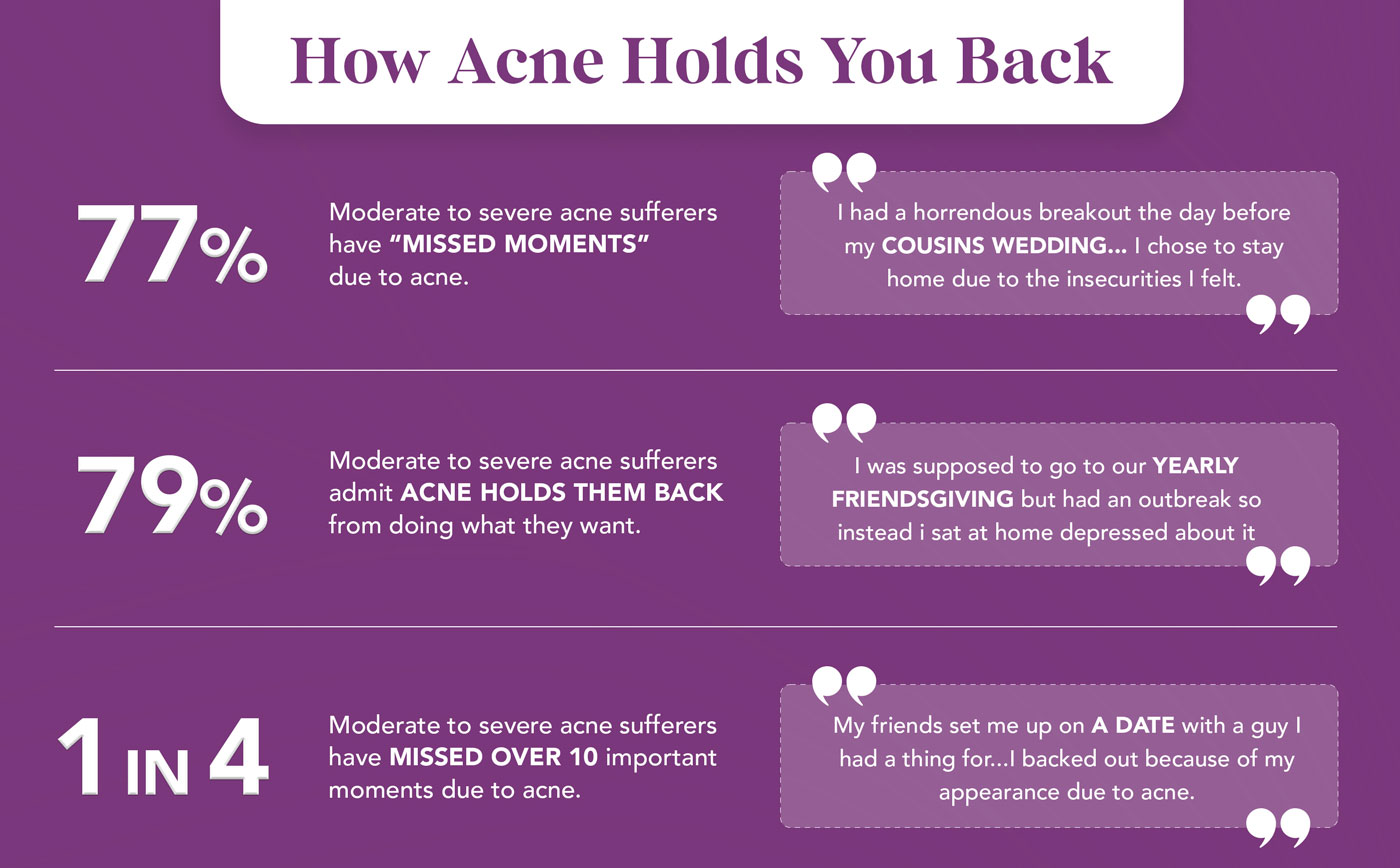 acne infographic